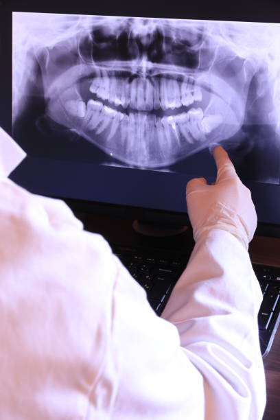 Best Emergency Treatment for Oral Infections in Victory Gardens, NJ